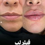 دکتر محمد باحجب شانه بندی