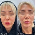 دکتر محمد باحجب شانه بندی