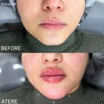 دکتر محمد باحجب شانه بندی