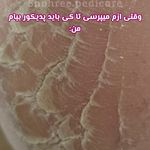 پدیکورتخصصی شهره