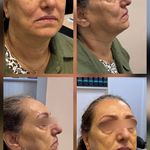 کلینیک پوست،مو،زیبایی و لیزر دالیا