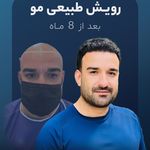 کلینیک پوست و کاشت مو ارغوان