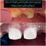 دندانپزشکی متخصص کودکان و نوجوانان زارعی