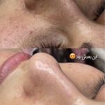 فیشال تخصصی پوست هلیا