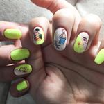 کاشت ناخن لوتوس