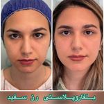 مرکز بلفاروپلاستی فوق تخصصی رز سفید