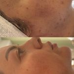 خدمات تخصصی پوست و فیشال سندی