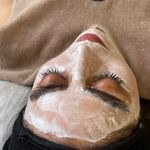 فشیال و پاکسازی پوست مهشید