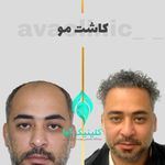 کلینیک تخصصی پوست و کاشت مو آوا