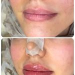 کلینیک پوست،مو وزیبایی مانلی(دکتر دهقان)