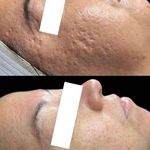 فیشیال پوست و رفع مشکلات پوستی