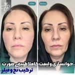 کلینیک زیبایی دکتر فرشاد رحیمی