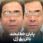 کلینیک زیبایی مانشید