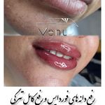 سالن زیبایی نداروحانی رفتار