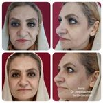 دکتر محمدحسین باقری کاشانی