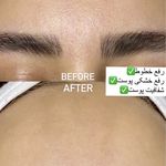 فیشال تخصصی پوست هلیا