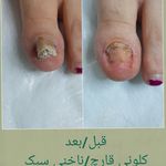 پدیکور و پودولوژیSD