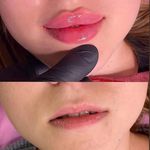 کلینیک پوست وزیبایی ومرکز تخصصی فیلربادی