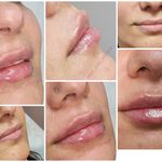 کلینیک زیبایی و لیزر مایا (دکتر وحیدی)