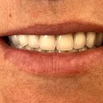 لابراتوار دندانسازی نوین