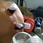 حجامت، زالو درمانی، فصدخون.برداشتن خال امجدیان