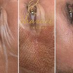 فیشال و پاکسازی پوست درنواب