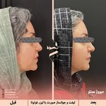 مرکز پزشکی و زیبایی میروژ سنتر