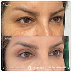 کلینیک پوست مو و زیبایی نوین ایرانا