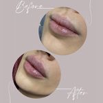 کلینیک زیبایی لاغری لیزر دانا