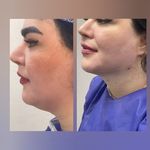 کلینیک لیزر و زیبایی مهرُنا