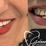 کلینیک دندانپزشکی دکتر گلنوش قاسم زاده