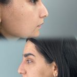 کلینیک لیزر  کندلاوزیبایی پوست ومو آیشیل