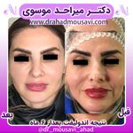 دکترمیراحدموسوی