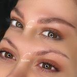 میکروبلیدینگ اسما بابائی