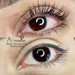 میکروبلیدینگ مرجان