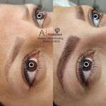 میکروبلیدینگ مرجان