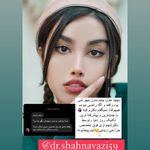 جراحی زیبایی بینی بدون بیهوشی شهنوازی