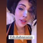 جراحی زیبایی بینی بدون بیهوشی شهنوازی