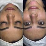 پاکسازی پوست و مو مهسام