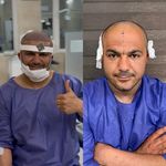 کاشت تخصصی مو،ابرو و ریش هاشمیان