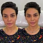كلينيک زیبایی سانيل