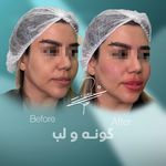 مطب پوست زيبايی ليزر دکتر شاه نعمت الهی