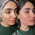 کلینیک پوست و زیبایی ژیلاوَش