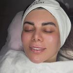 خدمات تخصصی فیشیال مهسا پورنجف