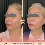 مرکز پزشکی و زیبایی میروژ سنتر