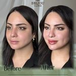 کلینیک زیبایی بلژو