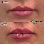کلینیک پوست،زیبایی ولیزر وکاشت مو الماس