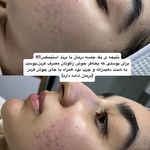 سالن زیبایی آوا بیوتی