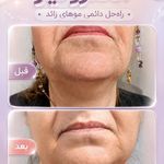 مرکز لیرز و جوانسازی پوست شهربانو