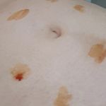 متخصص طب سنتی و سوزنی دکتر اختری